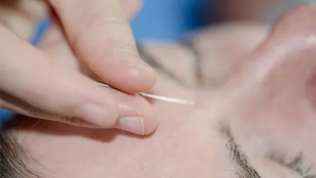 treatment-time_image